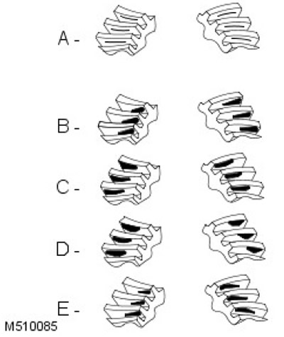 5. E = Правилна подложка на зъбно колело: Увеличете страничния просвет.